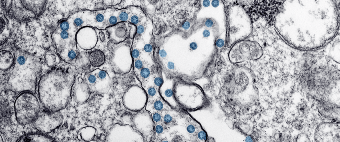 cell under a microscope