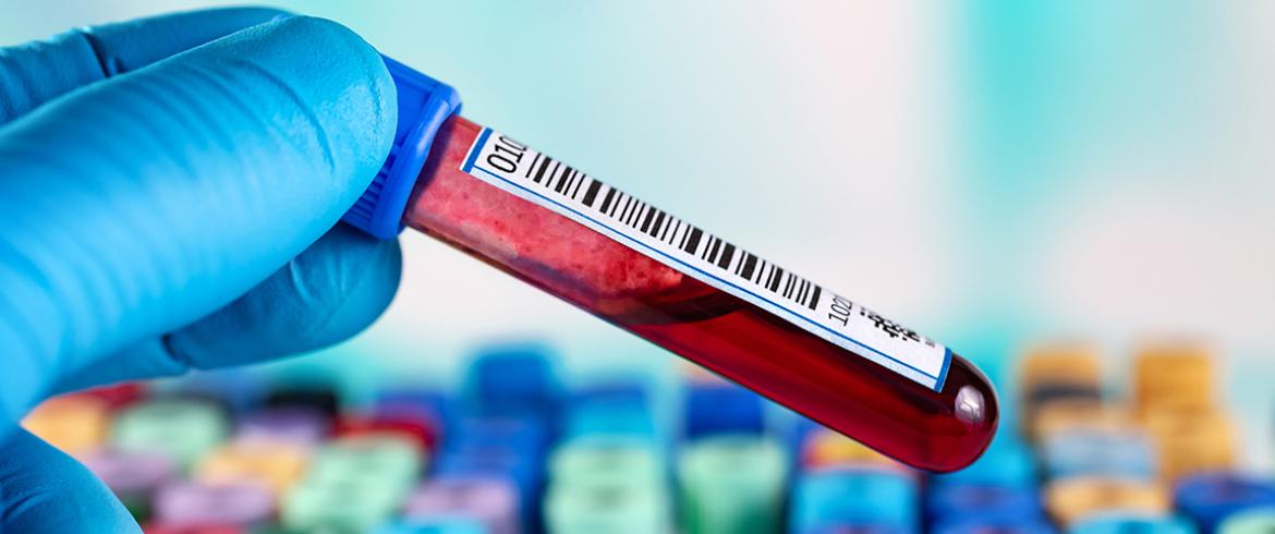 closeup of hand holding vial of red blood