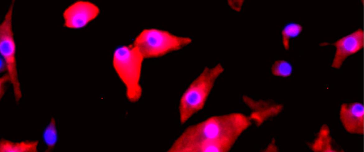 photo of red and purple stained cells on black background from inside a microscope