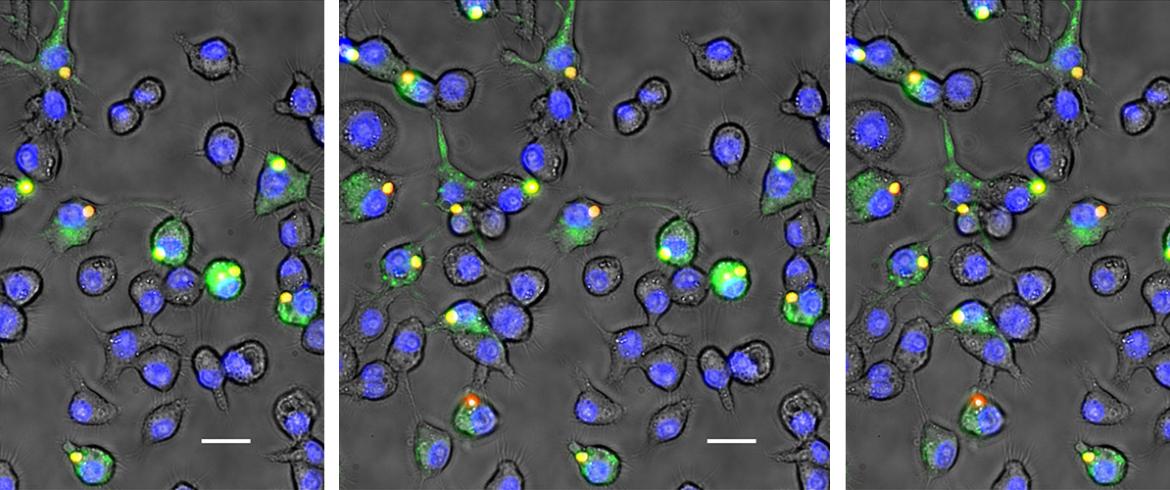 miroscope photo of macrophages colored purple and green on a black background
