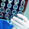 white gloved hand holding xray film with a series of mri brain images
